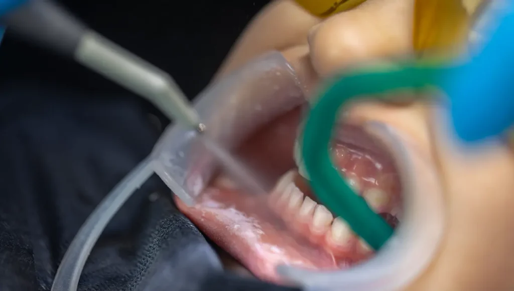 Dentálna hygiena